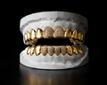 Custom Grillz Consultation